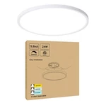 15.8 Inch Dimmable Led Ceiling Light Flush Mount, Low Profile 24W 3000K-4000K... New. Price: $66.21.